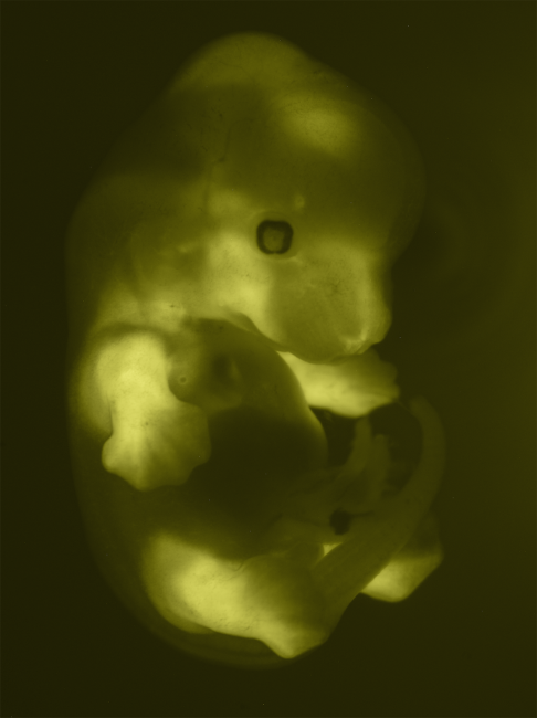 embryo